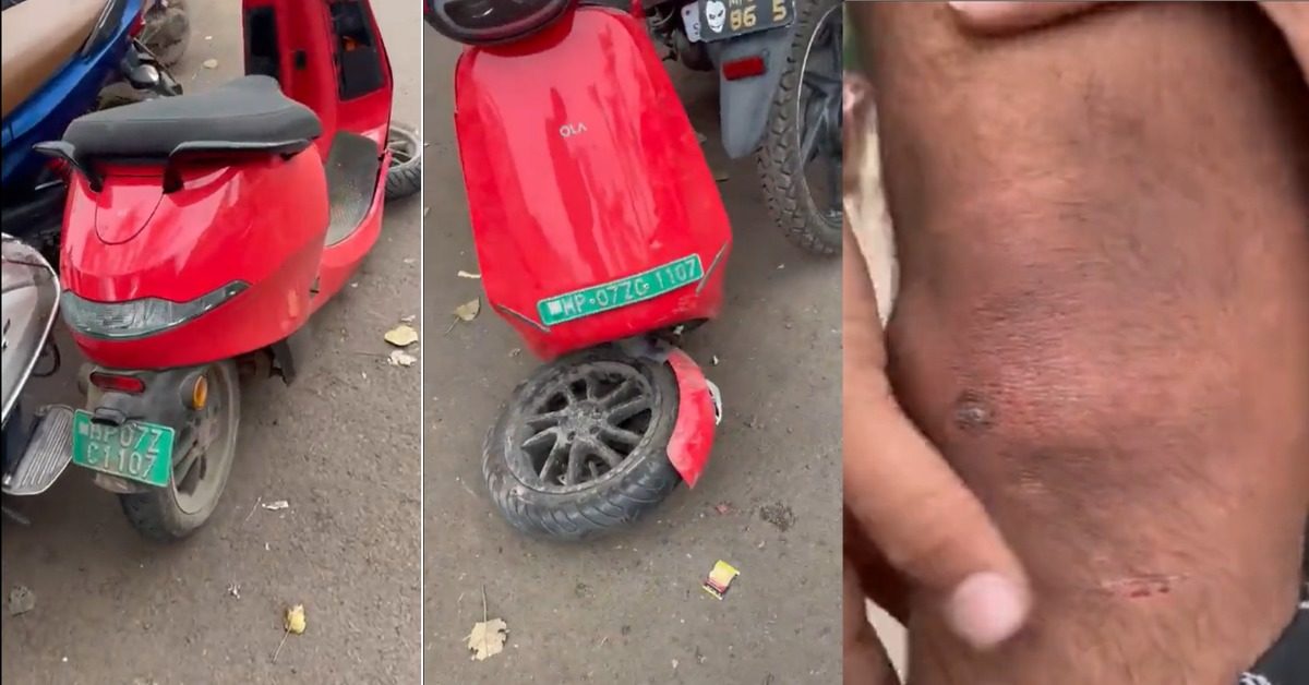 Front suspension of another Ola S1 electric scooter breaks rider injured